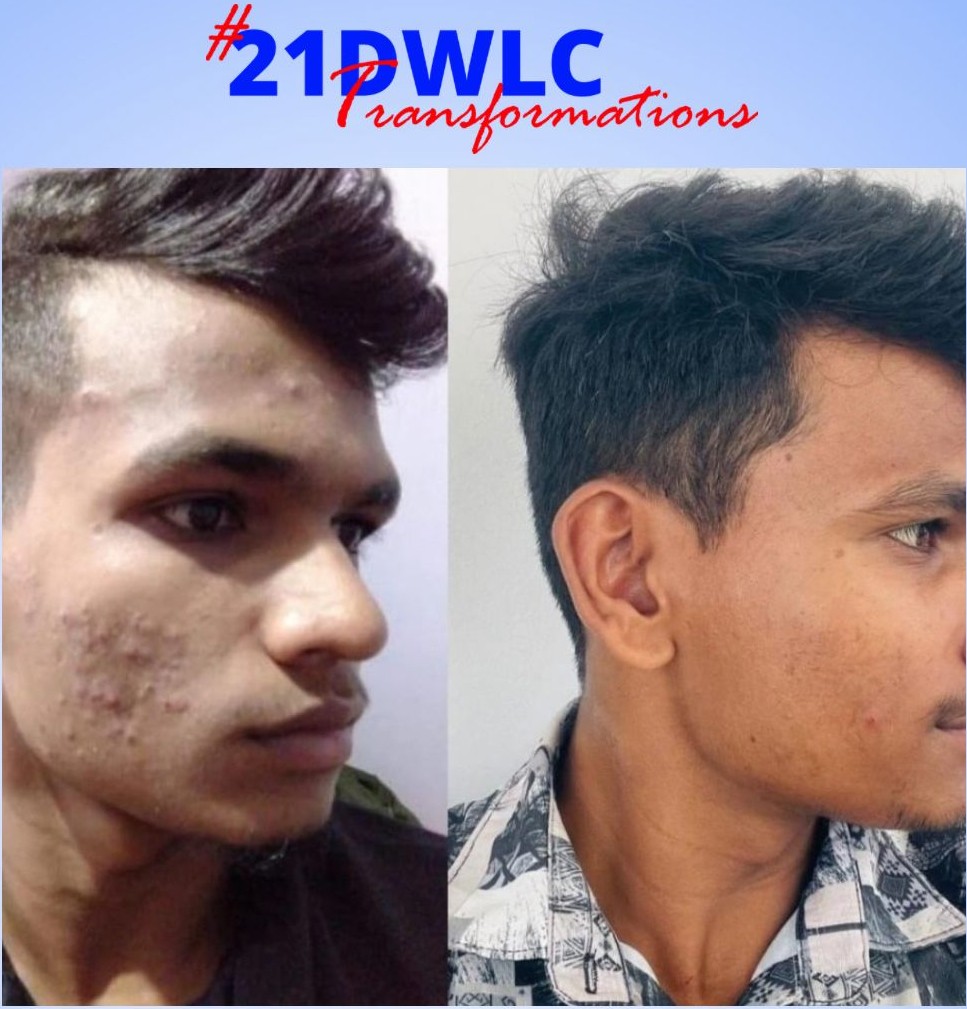 Skin Transformation