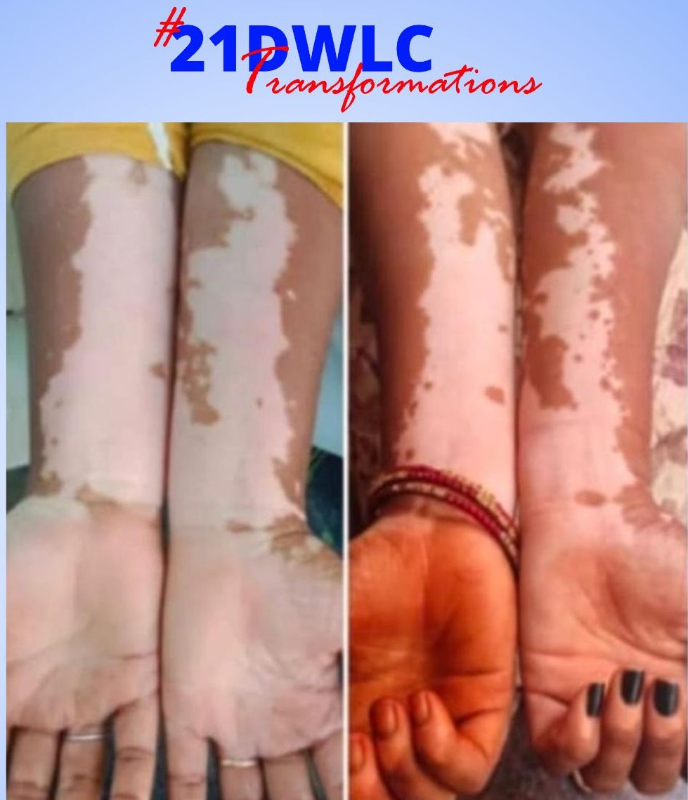 Skin Transformation