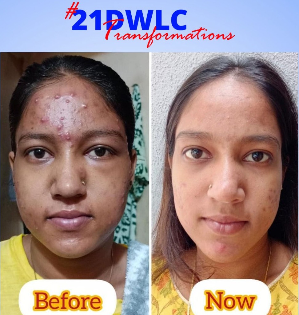 Skin Transformation