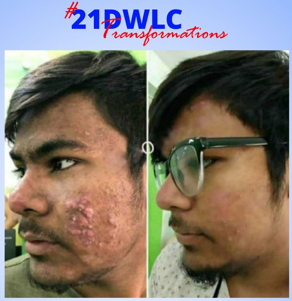 Skin Transformation