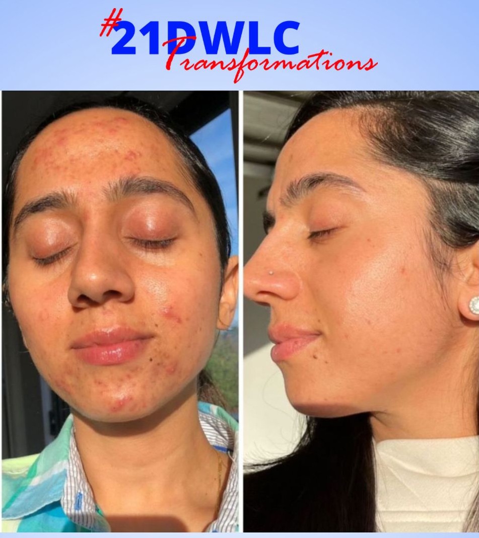 Skin Transformation