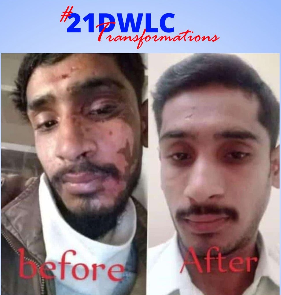 Skin Transformation